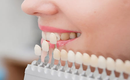 Beste Zahnklinik in der T&uuml;rkei​, Myra Dental Clinic, Antalya | Beste Zahnklinik in der T&uuml;rkei​